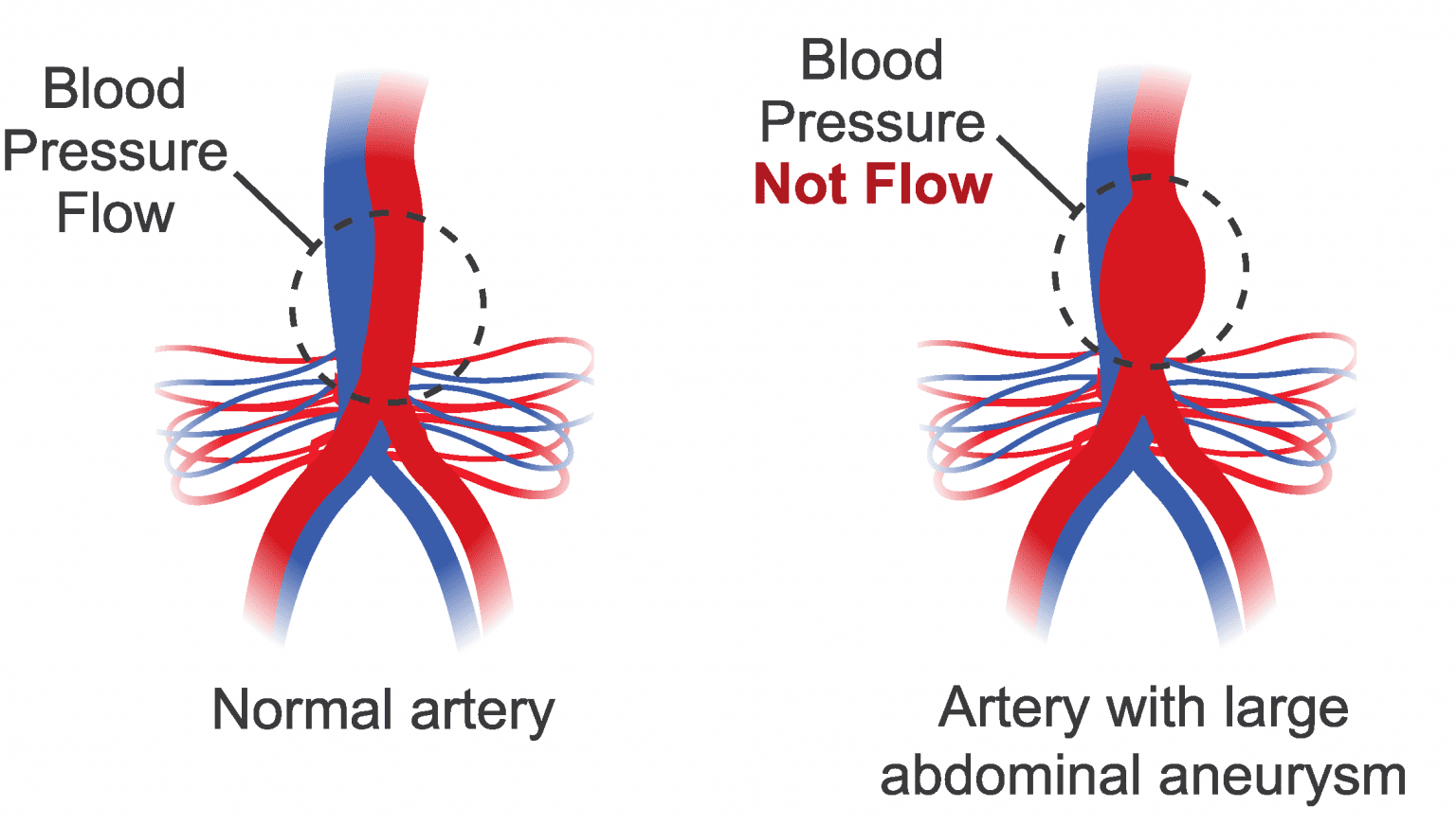 Hypertension and Heart Disease - Alabama Cooperative Extension System